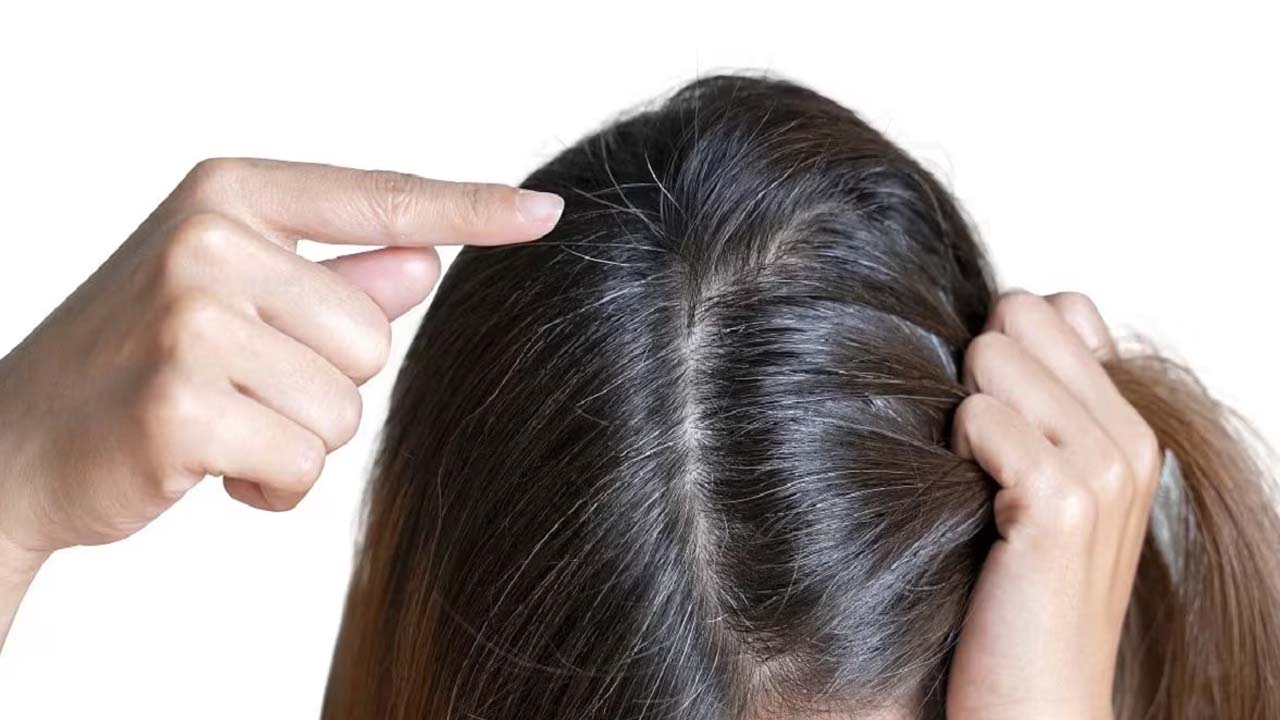 Health Tips : Suffering from gray hair?  These tips are for you..